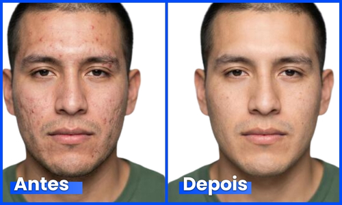 Depoimento real 2