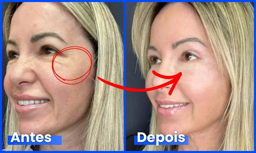 Depoimento real 3